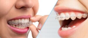 Orthodontics