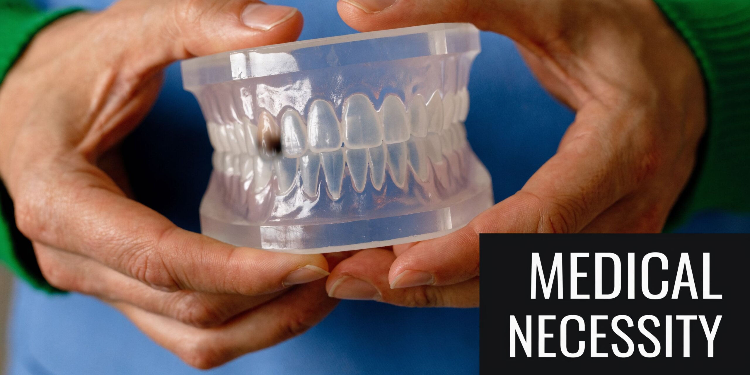 A dental professional holding a clear plastic model of teeth with a dark mark on a tooth.