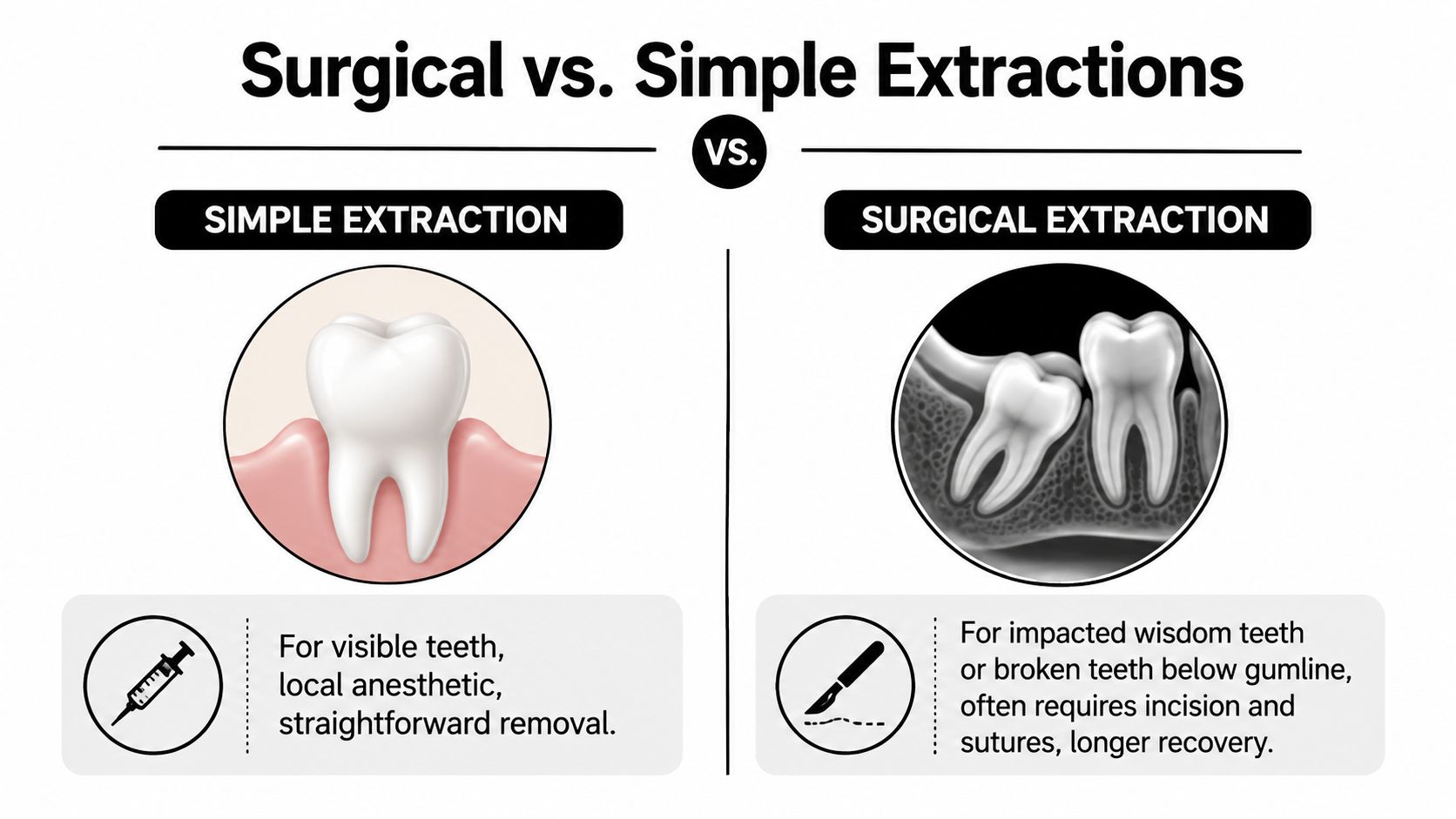 A comparison infographic showing the difference between simple tooth extractions for visible teeth and surgical extractions for impactions.
