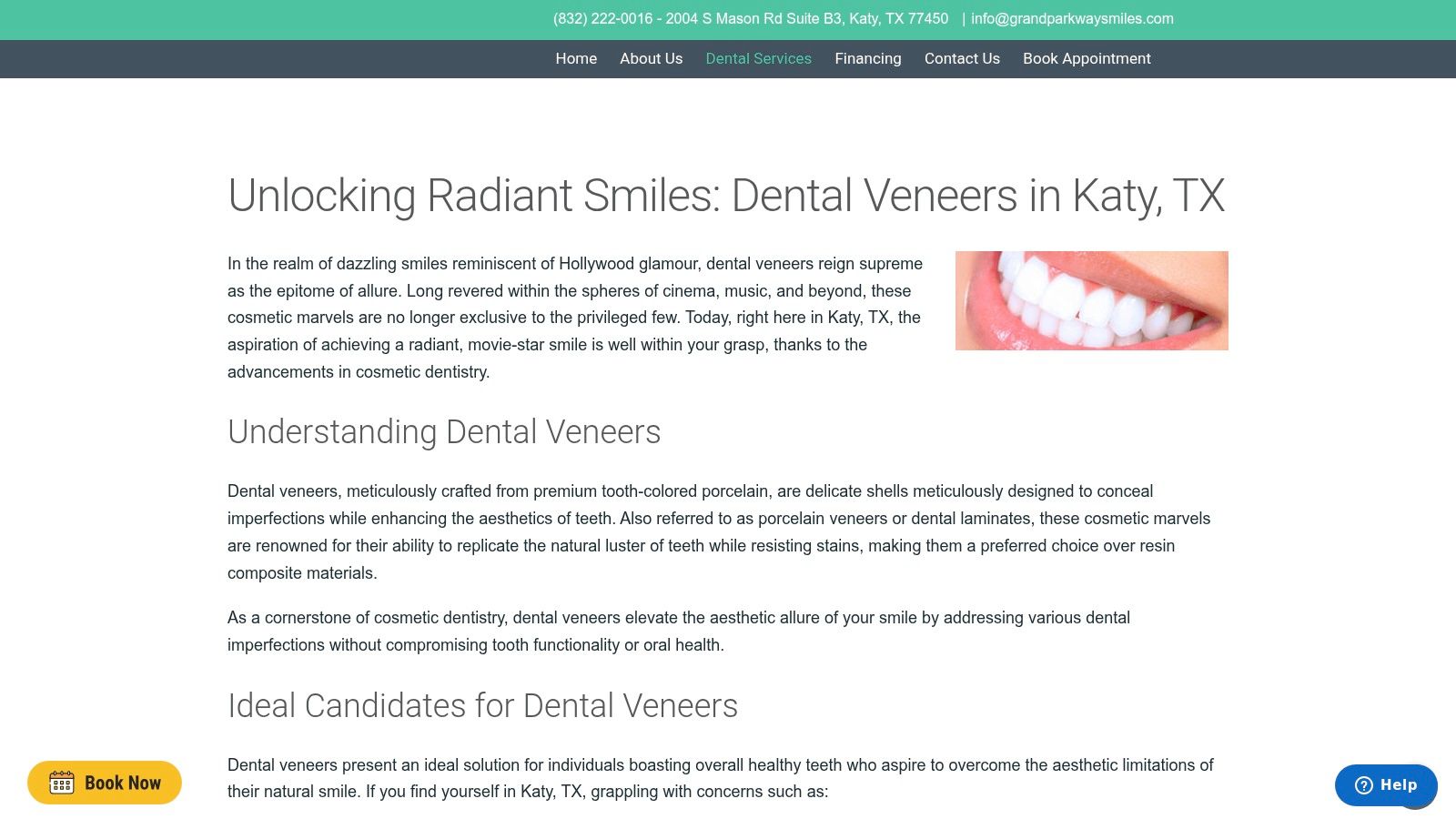 Dental Veneers in Katy, TX – Grand Parkway Smiles